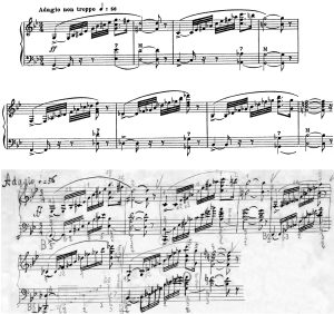 Ettore Pozzoli e la fisarmonica