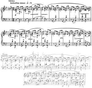 Ettore Pozzoli e la fisarmonica